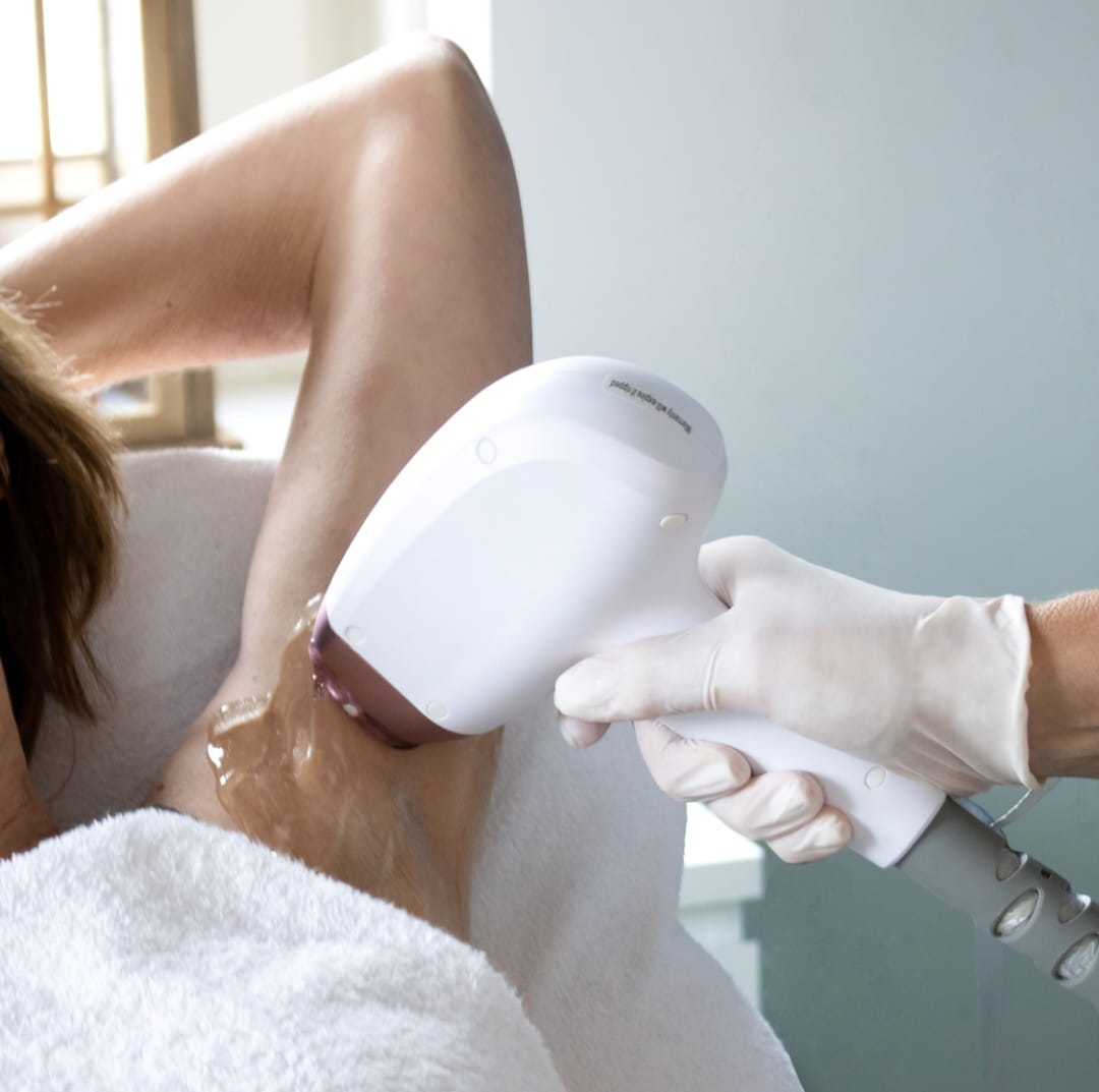 a person getting laser hair removal